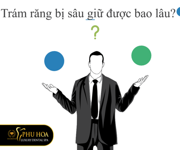 tram-rang-giu-duoc-bao-lau