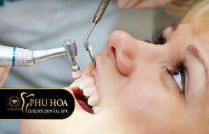 tai-sao-nen-di-lay-cao-rang