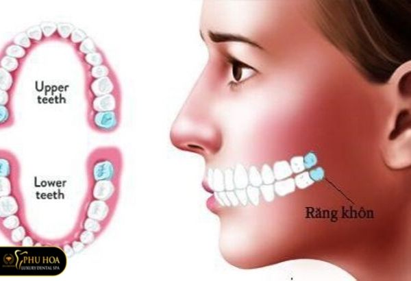 giai-dap-rang-khon-co-may-cai-may-chan