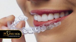 quy-trinh-nieng-rang-invisalign