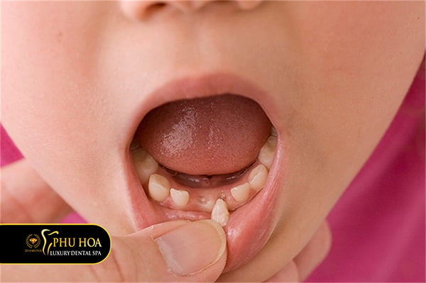 rang-sua-la-gi-vai-tro