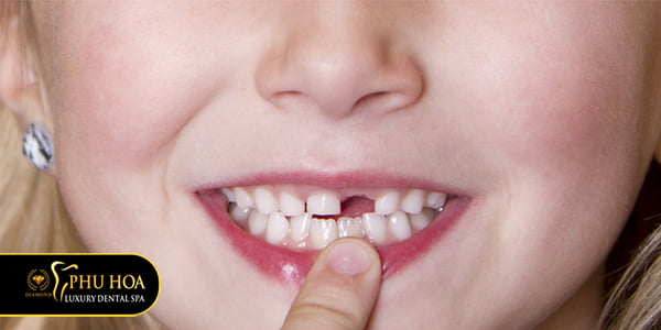 rang-sua-la-gi-vai-tro