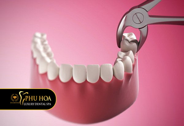 vi-tri-moc-rang-khon