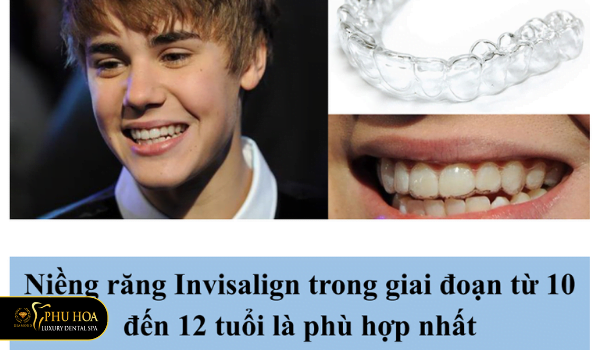 Do-tuoi-nieng-rang-invisalign-cho-tre