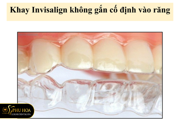 Giai-dap-nieng-rang-invisalign-co-dau-khong