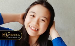 nho-rang-khenh-co-nen-khong