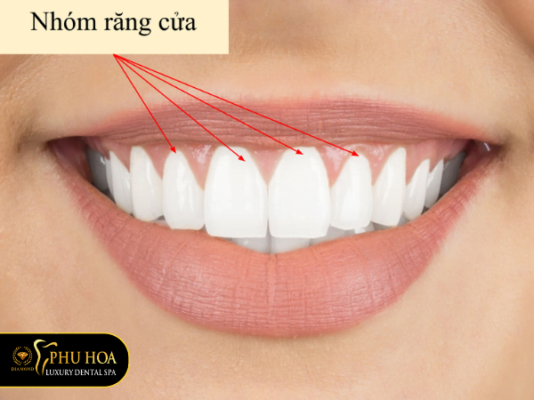 truong-hop-can-nho-rang-rang-cua