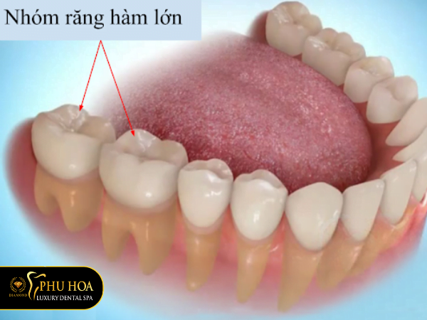 truong-hop-can-nho-rang-rang-ham-lon