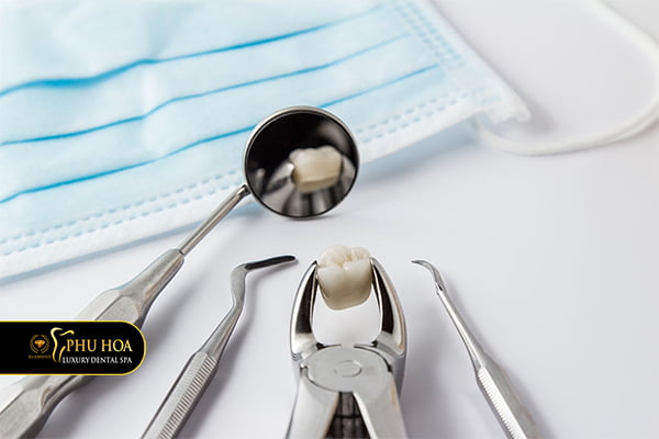 quy-trinh-nho-rang-khon-an-toan-tieu-chuan-1