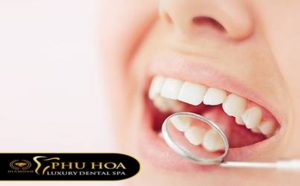 Sau-rang-la-gi-biet-ro-nguyen-nhan-dau-hieu-hau-qua-se-co-bien-phap-dieu-tri-5