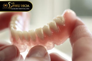 gia-trong-rang-bao-nhieu-bang-gia-chi-tiet-cac-phuong-phap-trong-rang