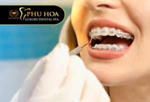 nieng-rang-tai-nha-co-tot-khong-co-hieu-qua-khong