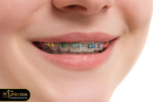 Nieng-rang-1-ham-gia-bao-nhieu