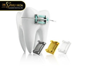 nieng-rang-mac-kim-loai-gia-bao-nhieu-tien