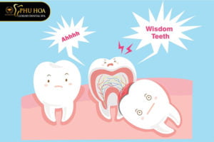 rang-khon-moc-lech-ham-tren-co-nen-nho-bo-hay-khong