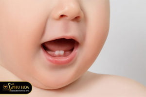 tai-sao-be-bi-sau-rang-o-giai-doan-1-2-tuoi-cha-me-nen-xu-ly-the-nao