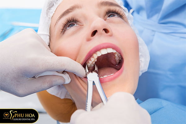 nguyen-nhan-bieu-hien-va-cach-dieu-tri-khi-moc-rang-khon-sung-mu