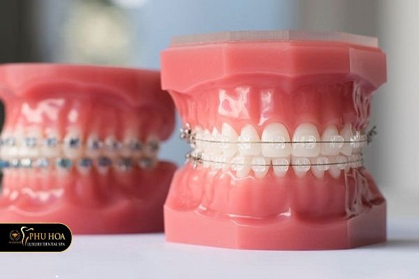 nieng-rang-mac-cai-su-tu-buoc-1