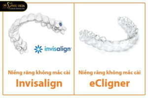 nieng-rang-thao-lap-la-gi-co-hieu-qua-khong