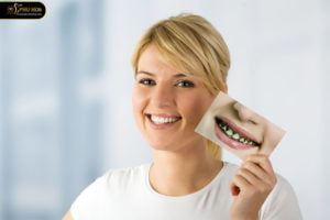 rang-cua-bi-sau-nguyen-nhan-va-cach-dieu-tri-hieu-qua-nhat