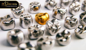 trong-rang-su-kim-loai-co-tot-khong-co-ben-khong