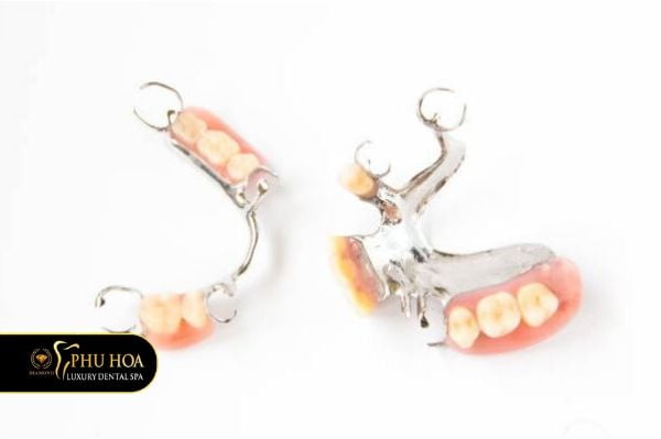 Trồng răng hàm dưới bao nhiều tiền bằng hàm giả tháo lắp 